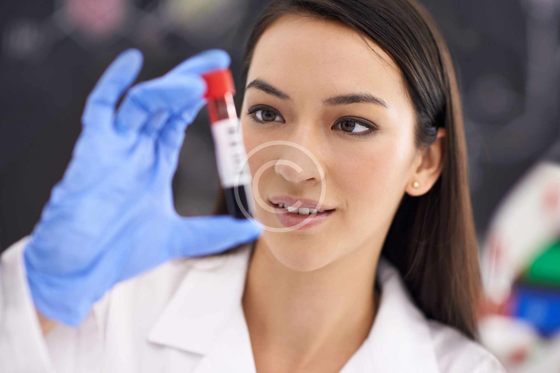 Pregnancy Blood Test Kanyimbo Hospital pregnancy-blood-test-kanyimbo-hospital
